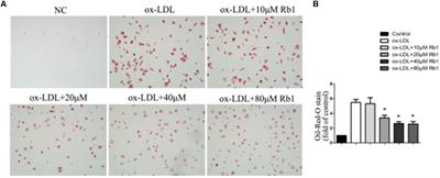 Ginsenoside Rb1 Enhances Atherosclerotic Plaque Stability by Improving Autophagy and Lipid Metabolism in Macrophage Foam Cells